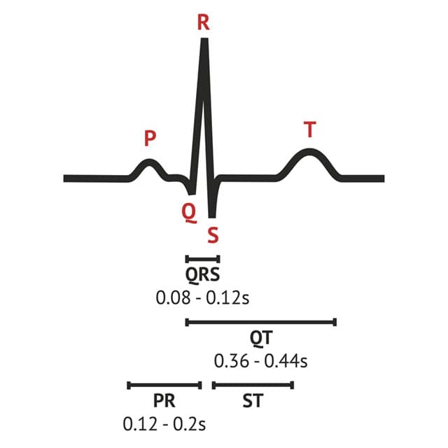 ECG Basics