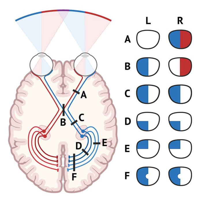 Cranial Nerve Exam